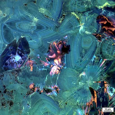 Внутренняя красота: камни в почках под микроскопом краше кораллов (фото) |  Куб Медиа | Дзен