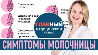 Молочница - симптомы и причины у женщин. Как выглядит молочница (фото 1-4).  Кандидоз - YouTube