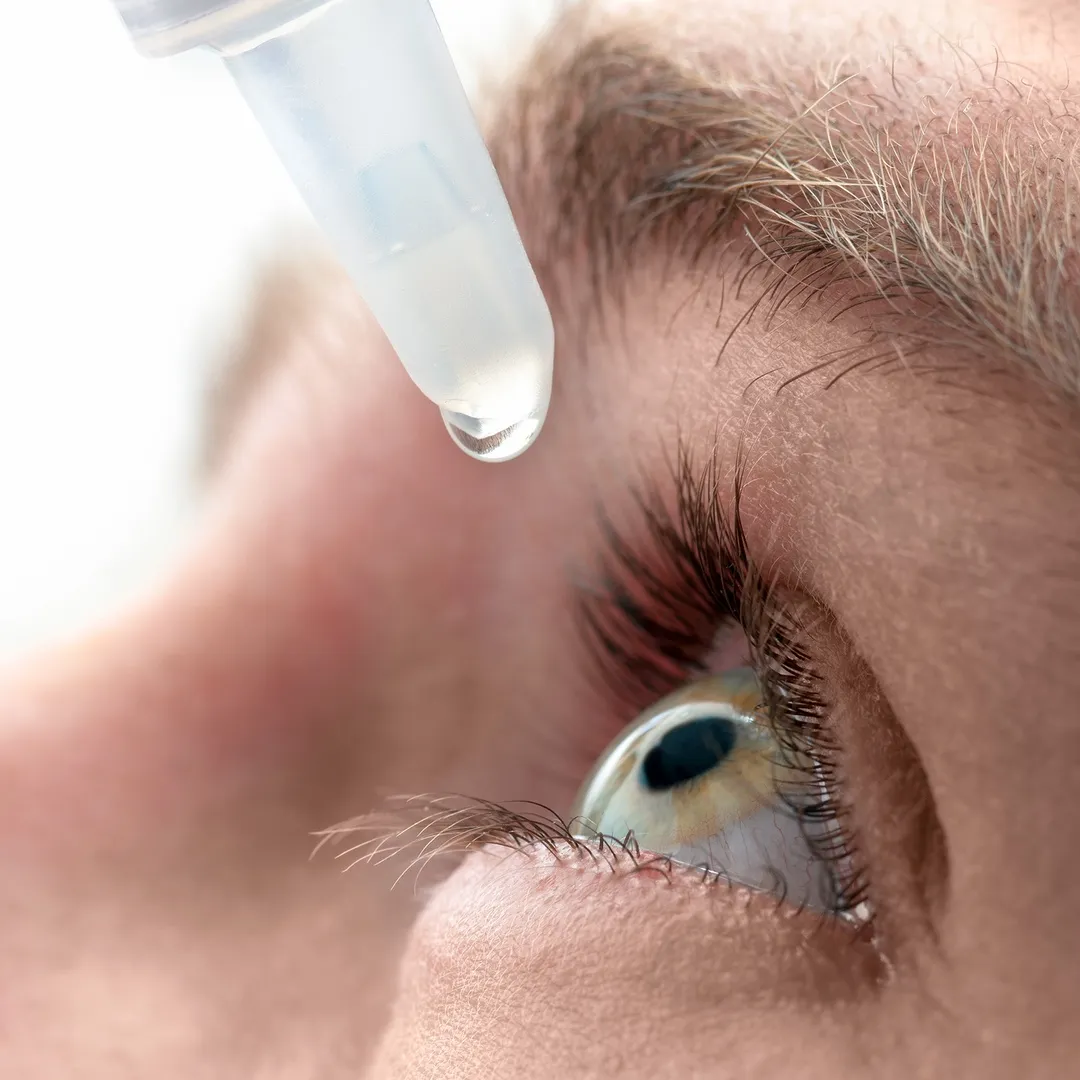 Для лечения заболевания глаз применяют 0.5. Капает в глаза. Капли для глаз. Капля для глаз. Введение лекарства в глаза.