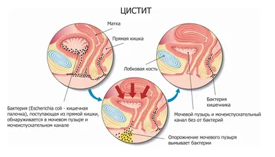 Лечение хламидиоза (хламидии) в Эс Класс Клиник Ульяновск по доступной цене