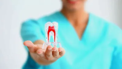 Киста зуба и все, что должен знать пациент стоматолога в Харькове