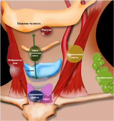 4.18. Кисты шеи