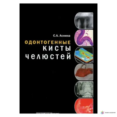 Одонтогенные кисты челюстей, Раиса Аснина, Практическая Медицина купить  книгу 978-5-98811-207-5 – Лавка Бабуин, Киев, Украина