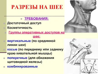 Спиральный и вертикальный меридианы вагуса, диагностика поражения на фоне  много-уровневых дисфункций