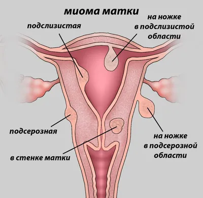 Пять гинекологических заболеваний, от которых не застрахована ни одна  женщина — Аман-Саулык