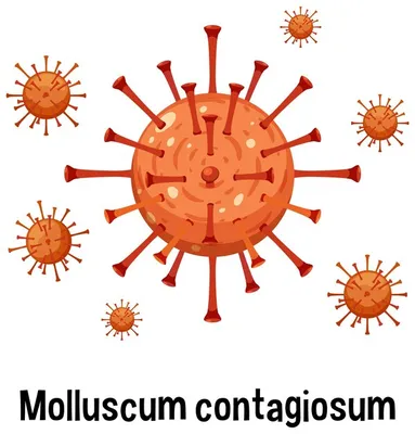 Контагиозный моллюск с текстом | Премиум векторы