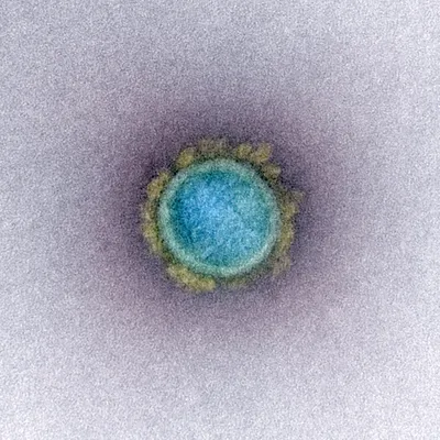 Новые снимки коронавируса SARS-CoV-2 под электронным микроскопом: фото -  новости Украины, Общество - LIGA.net