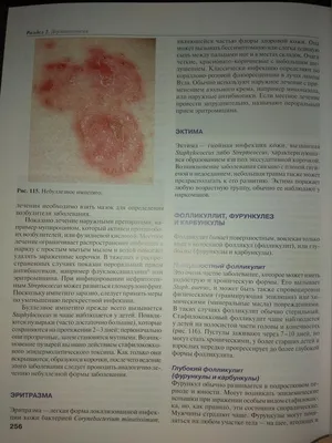 Иллюстрация 3 из 5 для Инфекционные и кожные заболевания. Учебник - Allen,  Aronson, Bloomfield | Лабиринт - книги.