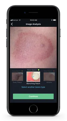 Создано приложение, определяющее болезнь по фото. Среди его поклонников —  глава Apple Тим Кук - Inc. Russia
