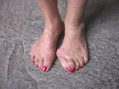 Ножки Стройные, Красивые ноги в …» — создано в Шедевруме