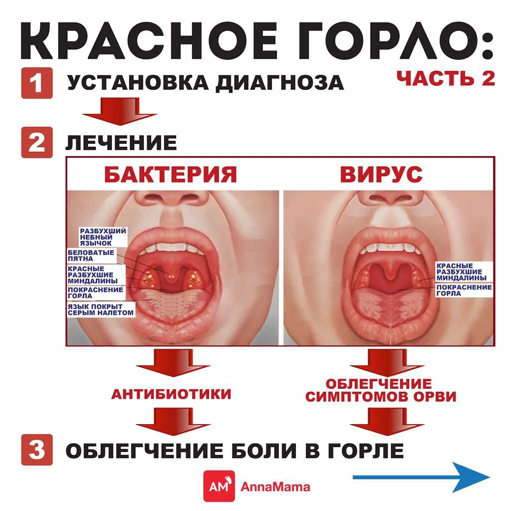 минет и красное горло фото 97