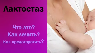 Лактостаз у кормящей матери симптомы и лечение - YouTube