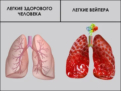 Минздрав предупреждает | Пикабу