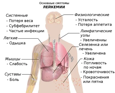 Рак крови симптомы и признаки у мужчин - КГБУЗ Горбольница №12