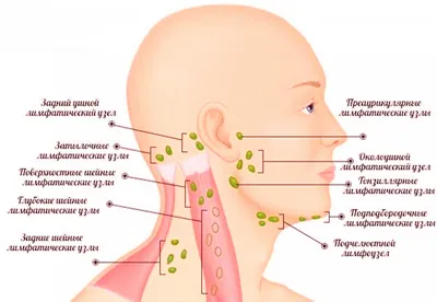 Где находятся лимфоузлы у человека фото на голове