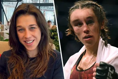 До и после боя. Как меняются лица бойцов ММА (Фото) | MMA Today | Дзен
