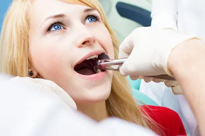 Сухая лунка зуба: незаметная проблема, требующая «скорой помощи»