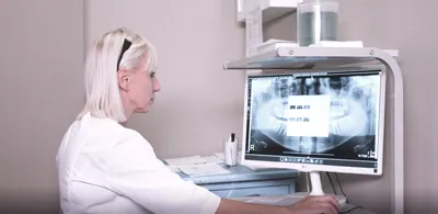 Болит зуб после удаления - стоматология ВитаДент Москва