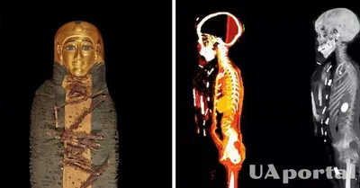 Ученые провели сканирование мумии Золотого мальчика из древнего Египта и  обнаружили 49 скрытых амулетов – фото