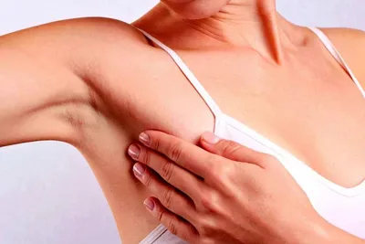 Фиброзно-кистозная мастопатия (ФКМ): причины, симптомы, диагностика и  лечение