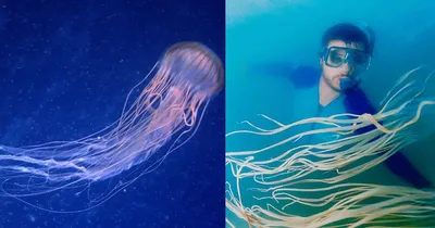 Укус медузы: как помочь пострадавшему | В Дорогу
