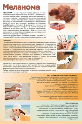 Меланома кожи - Заболевания кожи и ногтей. Уход за кожей - Минский  городской клинический центр дерматовенерологии