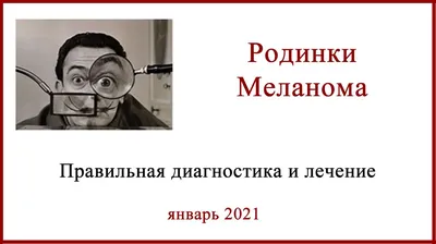 Меланома у детей и подростков - вместе