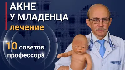 Акне новорожденных на лице - лечение, фото, диагностика. Уход за  новорожденным - онлайн курс - YouTube