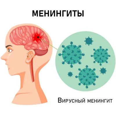 Вирусный менингит: симптомы, как передается, лечение, последствия