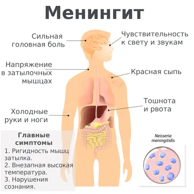 Менингит: симптомы, диагностика, лечение