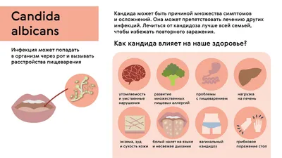 Правильное лечение молочницы у женщин и мужчин: симптомы, эффективные  схемы, лекарства, советы