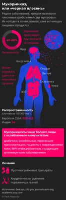 Мукормикоз, или “черная плесень”: что это за болезнь и кто в группе риска -  РИА Новости, 11.06.2021