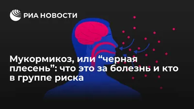 Мукормикоз, или “черная плесень”: что это за болезнь и кто в группе риска -  РИА Новости, 11.06.2021