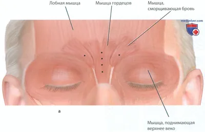 МАССАЖ ЛИЦА/ОБУЧЕНИЕ ОШ📍 on Instagram: \"МЫШЦЫ ЛИЦА ⠀ ⠀ ✓ Мышца опускающая  бровь (фото 2). Функция: опускает бровь книзу и несколько кнутри. Участвует  в «зажмуривании» глаз. Если она в спазме, то тянет