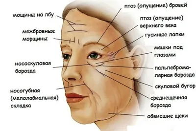 Ботулинотерапия лица цена в СПб