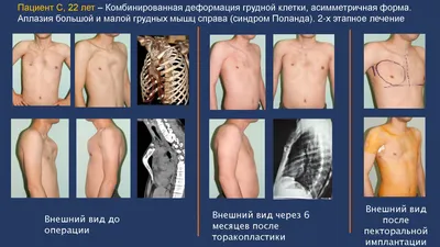 Гидравлическая кожа мужское многофункциональное тренировочное оборудование  фитнес-стик для мышц грудной клетки | AliExpress