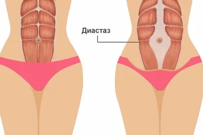 Идеал мужской красоты. Биоэнергетический бодинамический анализ. Часть 3.  Плоский живот