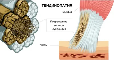 Плечевой сустав МРТ: нормальная анатомия | e-Anatomy