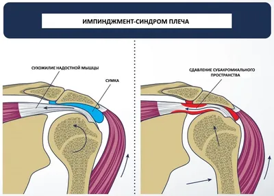 Дельтовидная мышца Надостная мышца Подостная мышца Малая круглая мышца  Подлопаточная мышца Большая - Школьные Знания.com