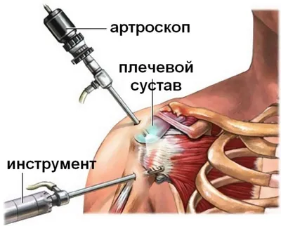 Большая круглая мышца