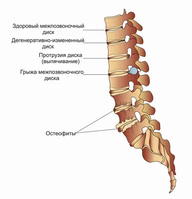 10 МИНУТ и НАТОПТЫШЕЙ и МОЗОЛЕЙ как не бывало. Простой и эффективный рецепт  - YouTube