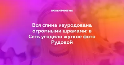 Вся спина изуродована огромными шрамами: в Сеть угодило жуткое фото Рудовой