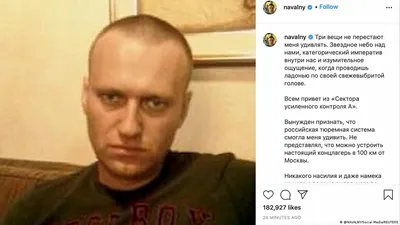 Тест Навального на коронавирус оказался отрицательным – DW – 07.04.2021