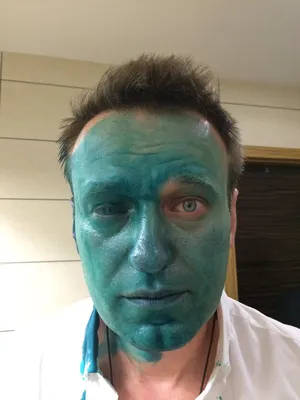 В России Навального облили зеленкой. Фото - Апостроф