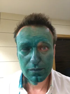 ФОТО: Навального госпитализировали после нападения с зеленкой в Москве -  Delfi RUS