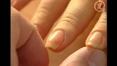 Заболевания ногтей: причины, типы и профилактика | WMJ.ru