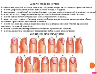 Продольные борозды на ногтях - 60 photo