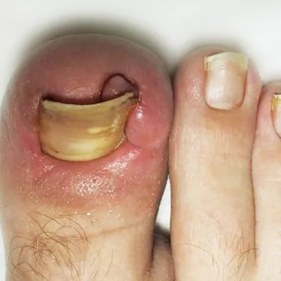Признаки болезни по состоянию ногтей. Восточная медицина: О каких болезнях  можно узнать по ногтям. О чем рассказывает диагностика