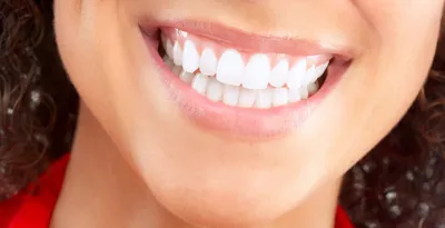 Как исправить кривые зубы и чем опасен неправильный прикус