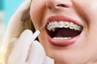 Чем опасен неправильный прикус | Блог Кремлевской стоматологии